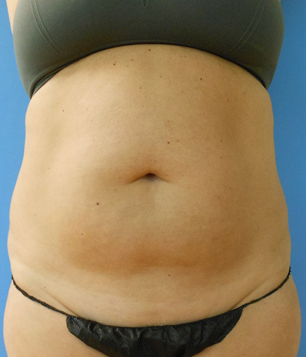 Close-up of a bare abdomen wearing a black bikini bottom against a blue background