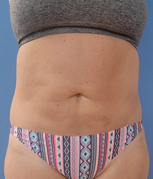 A person’s midsection wearing a gray top and patterned bikini bottom against a blue background