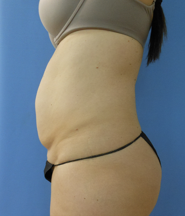 Side view of a person with visible abdominal contours and black underwear