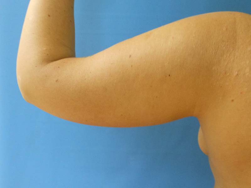 Close-up of a bare arm raised, with a background of solid blue