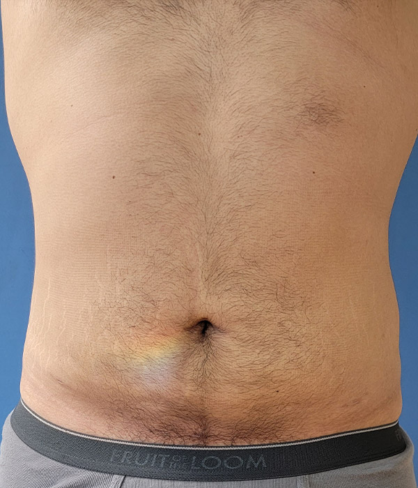 Bare male torso with light hair and a faint rainbow marking on the abdomen