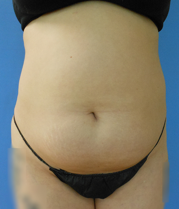 Image of a person’s midsection, visible skin and dark underwear against a blue background