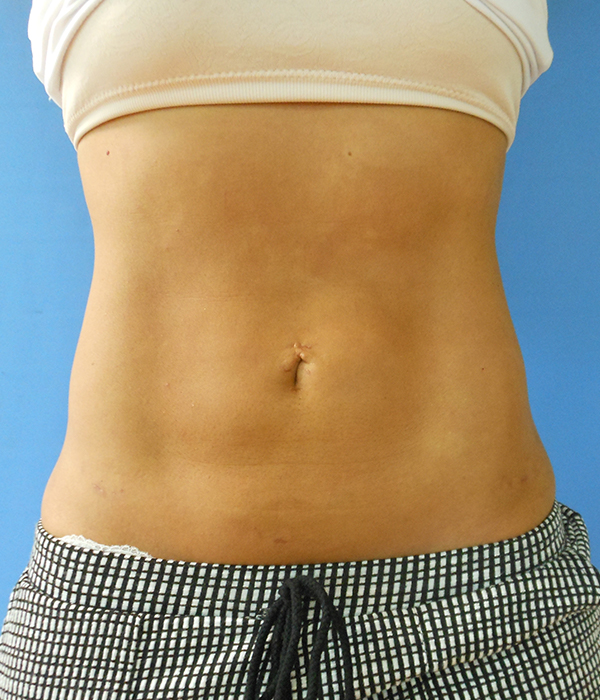 Exposed midsection of a person with a navel, against a blue background
