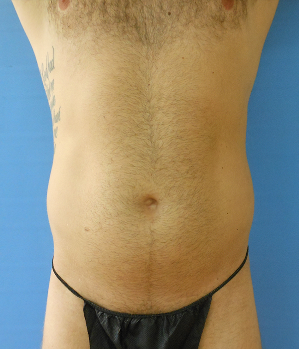 A male torso is shown, wearing a black thong, with light hair and a tattoo on the left side