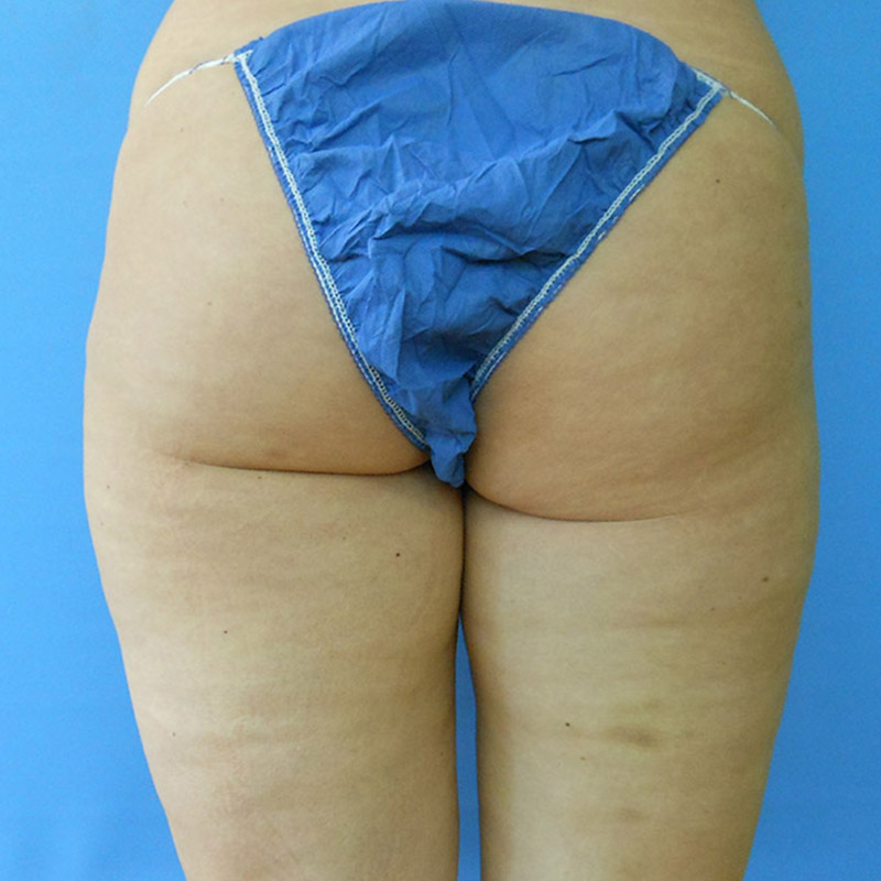 Rear view of a person wearing blue undergarments against a blue background