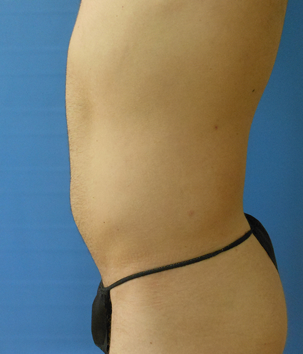 Profile view of a bare torso with a black strap around the waist against a blue background