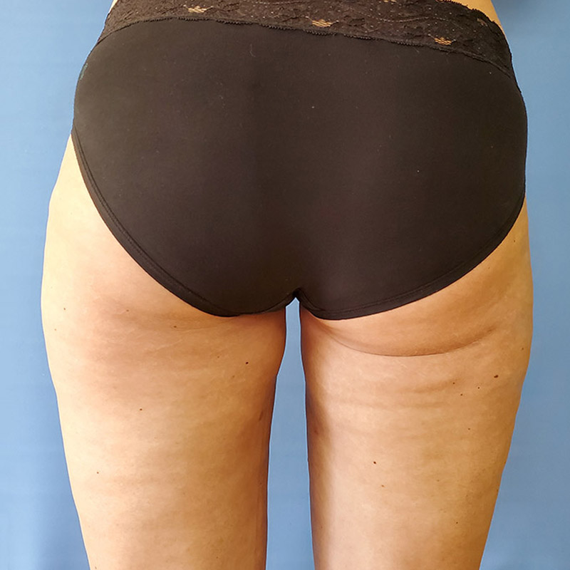 Rear view of a person wearing black underwear against a blue background