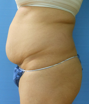 Side view of a torso with a noticeable belly wearing a blue garment. Blue background