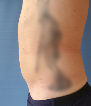 Side view of a person's torso with blurred details