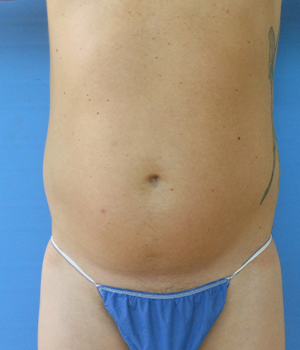 Close-up of a bare abdomen with a tattoo, wearing blue underwear, against a blue background