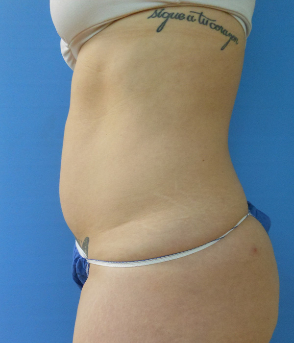 Side view of a person’s torso with visible skin and a tattoo on the side