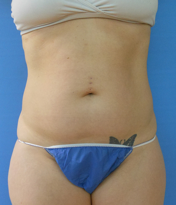 Person's torso wearing a bra and blue underwear against a solid blue background