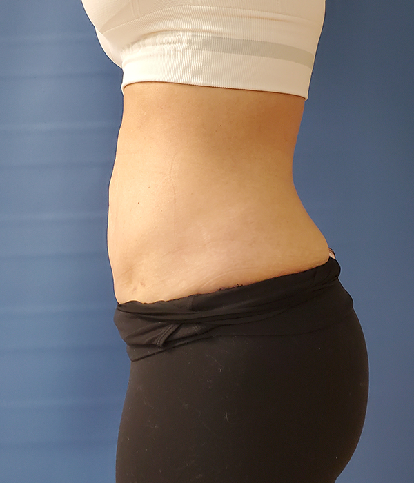 Profile view of a person’s torso wearing a sports bra and leggings