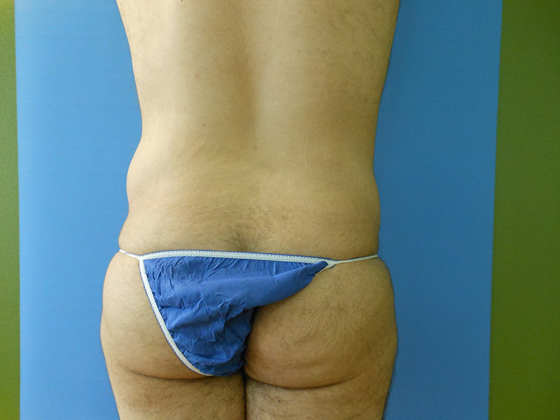 A person’s back, wearing blue swimwear, standing against a blue background