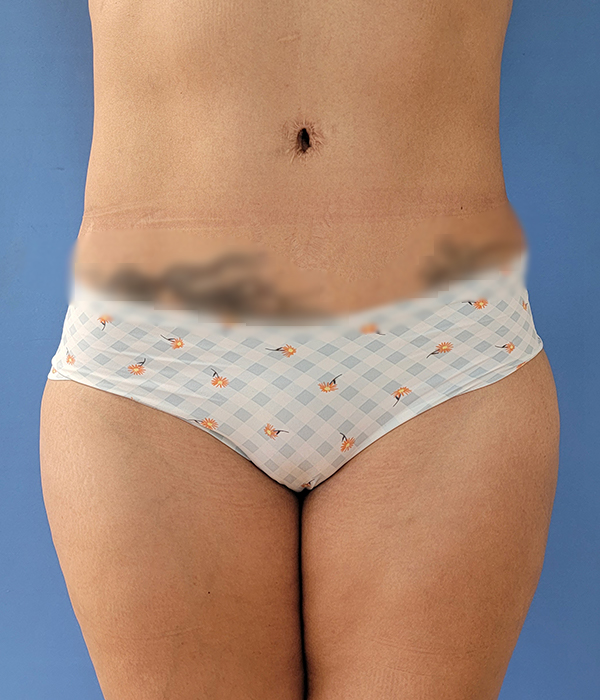 Person wearing light-colored underwear with a checkered pattern and small illustrations