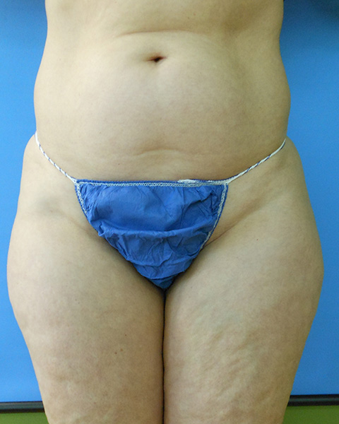 Close-up of a person's midsection wearing a blue thong against a blue background