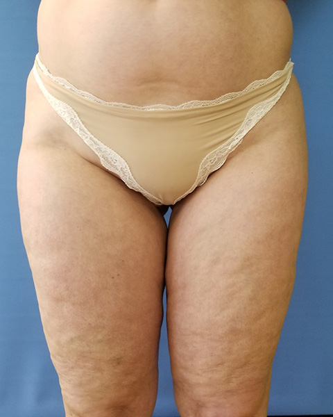 Close-up of a person's lower torso and thighs, wearing beige underwear. Background is blue