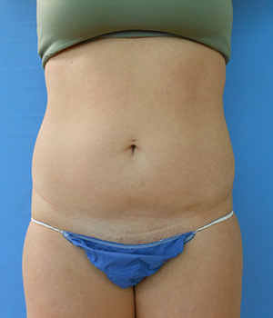 Image of a person’s waist and abdomen, wearing a tank top and blue underwear against a blue backgrou