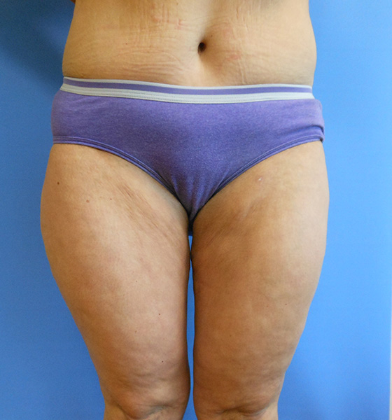 Person wearing purple underwear, standing against a blue background, showing thighs and midsection