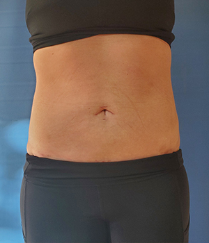 Bare midriff of a person wearing a black top and leggings, showing skin and natural features