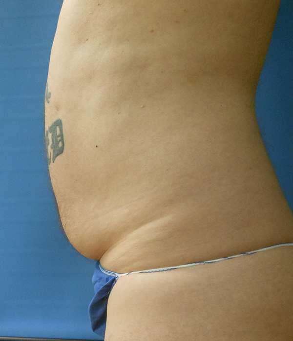 Side view of a torso with some body fat and a visible tattoo, against a blue background