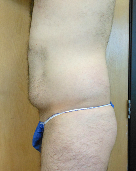 Side view of a shirtless person wearing blue swim bottoms, standing against a wooden background