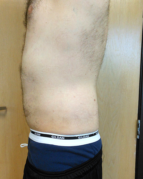 Side view of a person with a hairy torso wearing shorts and a waistband