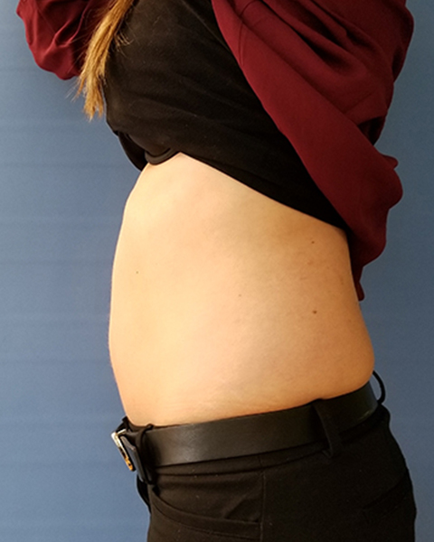 Side view of a person's abdomen, wearing a black top and belt