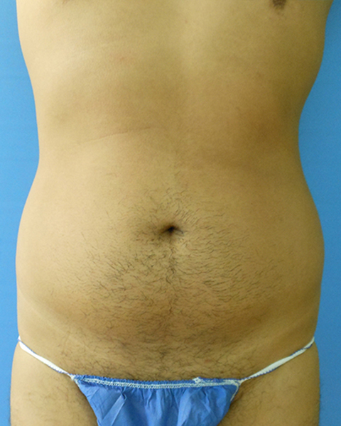 Male torso with a light tan and dark hair, wearing a blue cloth minimal covering