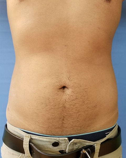 Close-up of a bare torso with short hair and a belly button, wearing pants with a belt
