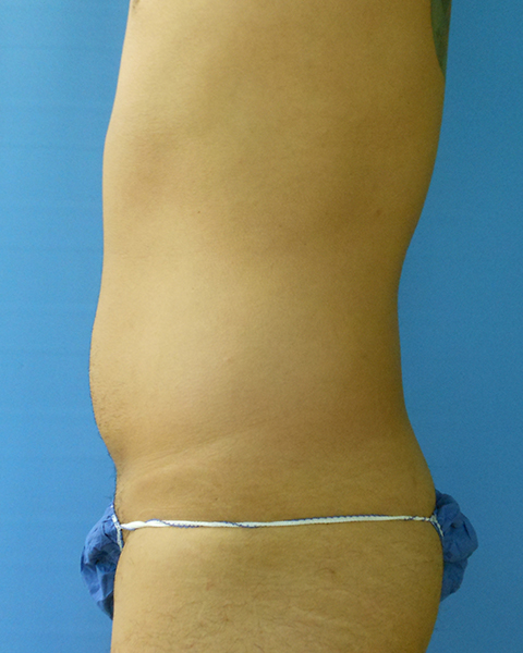 Profile view of a person wearing a minimal swimsuit against a blue background