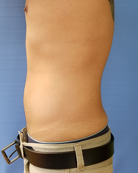 Side view of a person's torso, wearing beige pants and a black belt. Background is blue