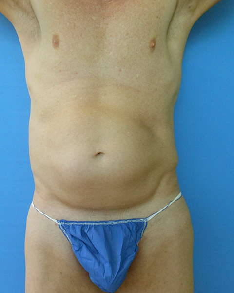 A male torso with a flat stomach, wearing a blue thong against a blue background