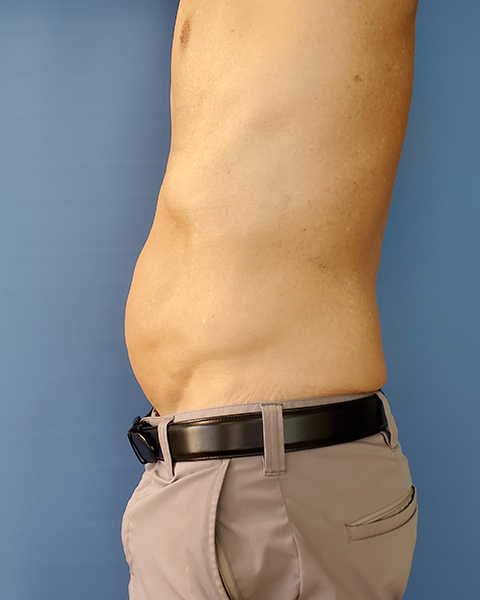 Profile view of a bare torso with visible stomach and a belt, against a blue background