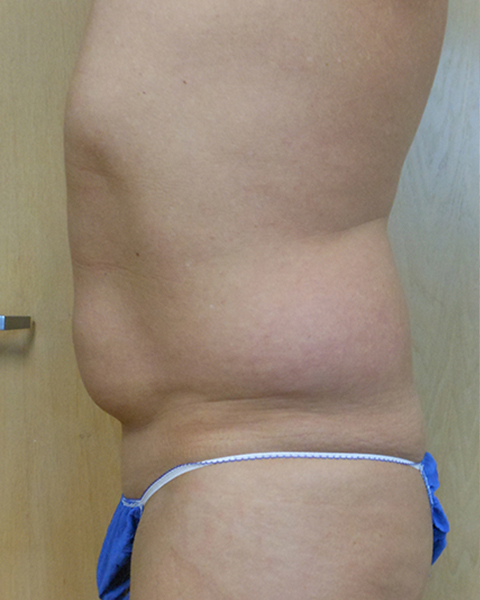 Side view of a person standing with visible abdominal area