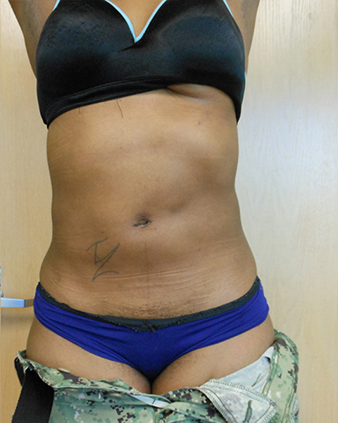 Person's torso wearing a black bra and blue underwear, partially covered by camouflage pants
