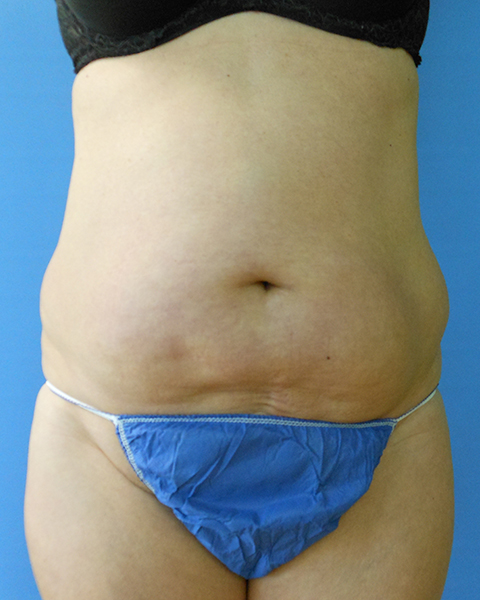 Front view of a person's torso, wearing a black bra and blue underwear against a blue background