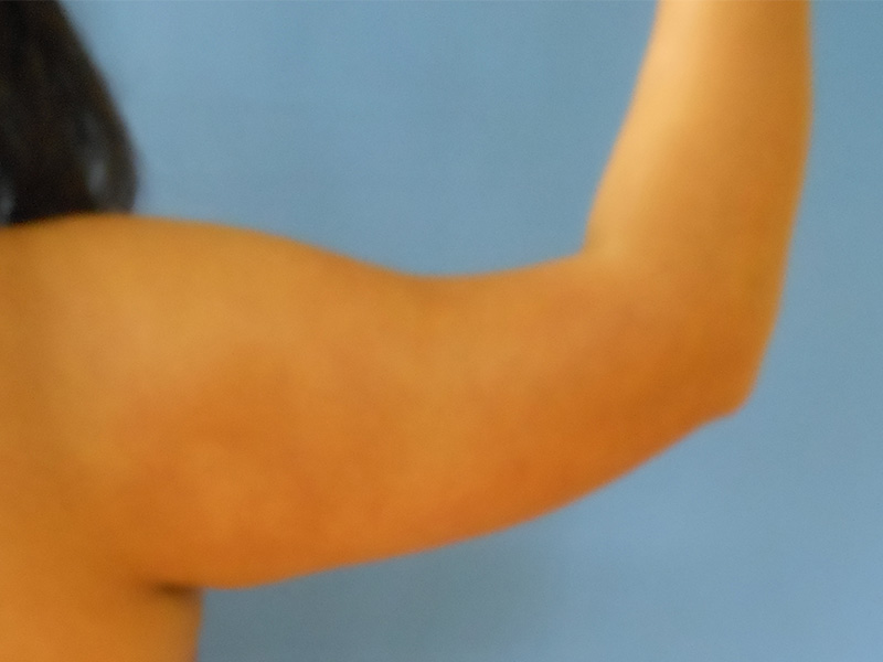Close-up of a person's bare arm raised against a blue background