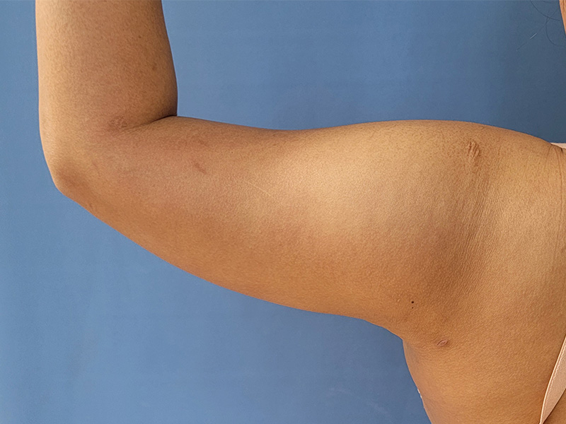 Close-up of a flexed arm against a blue background