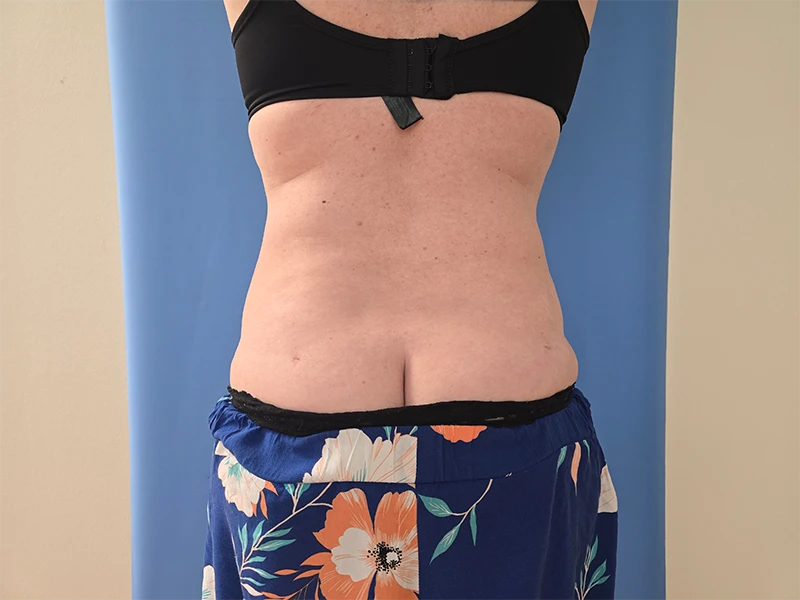 Person standing in a black bra and floral skirt against a blue background