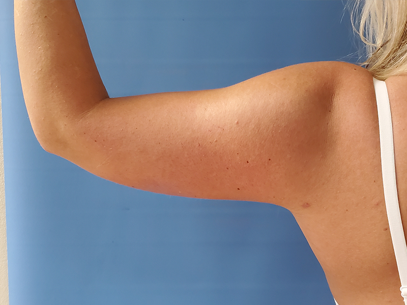 A close-up of a raised female arm against a blue background