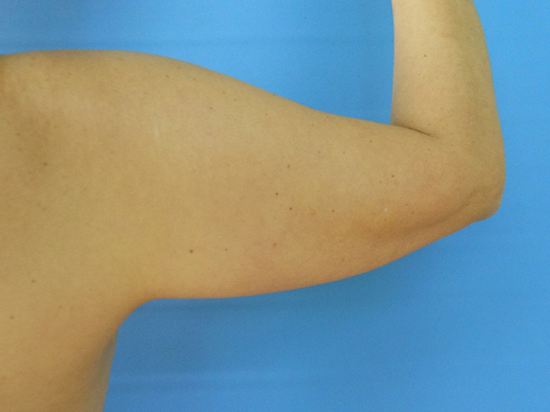 A close-up of a muscular upper arm against a blue background