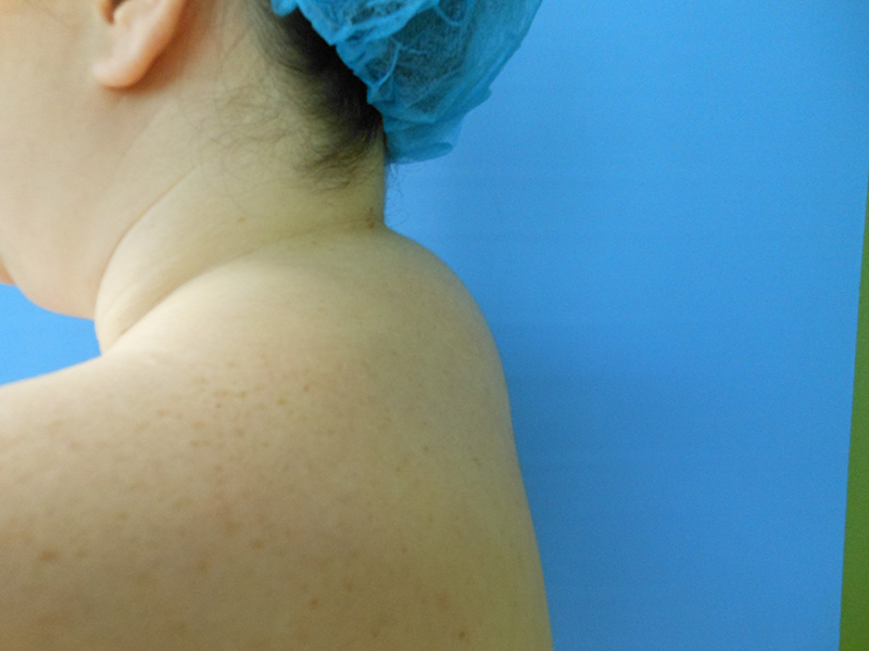 Close-up of a person's shoulder and neck against a blue background