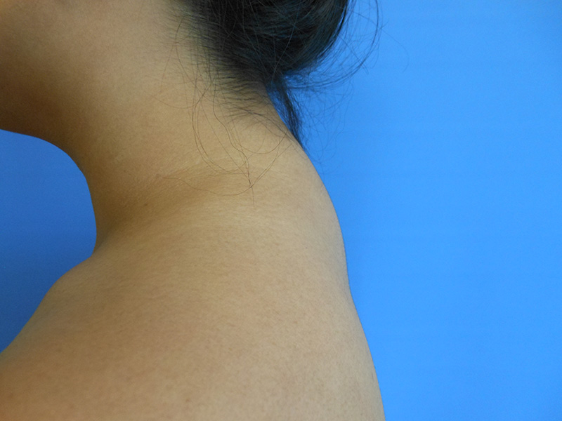 Close-up of the back of a neck against a blue background