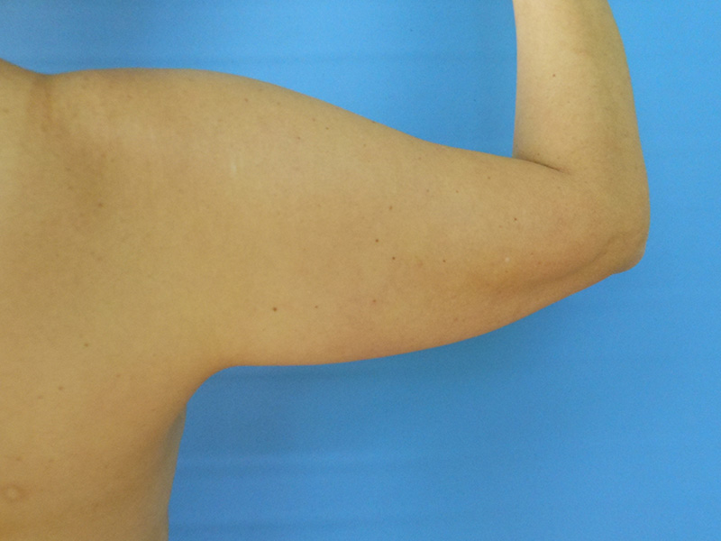 A close-up of a bare upper arm flexing against a blue background