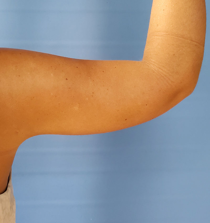 Close-up of a tanned arm raised against a blue background