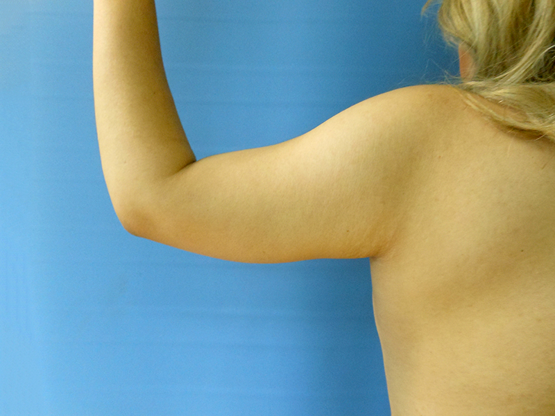 A bare shoulder and arm against a blue background
