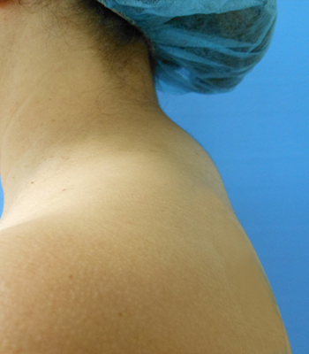 Close-up of a person’s neck and shoulder against a blue background