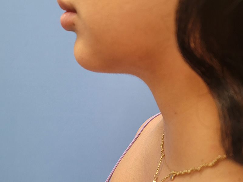 Profile view of a person with long hair, wearing a necklace, against a blue background
