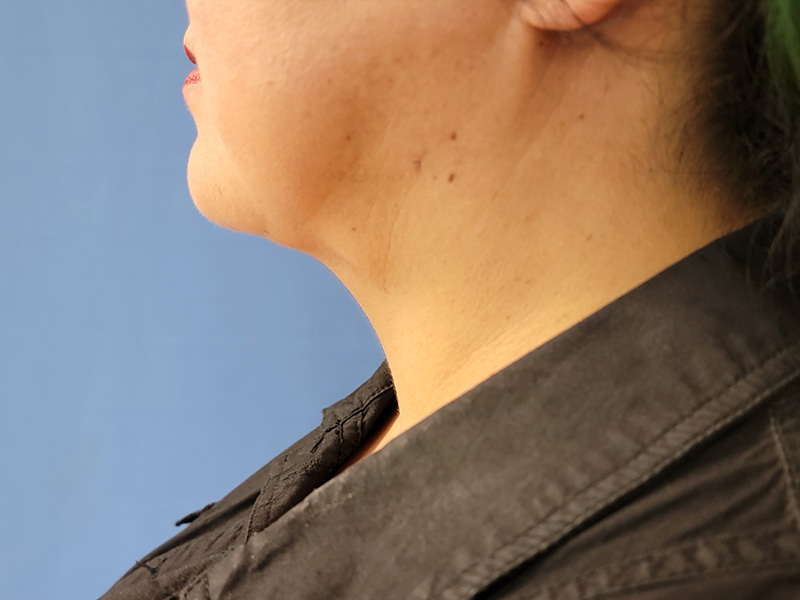 Profile view of a person with short hair, wearing a dark shirt against a blue background